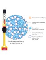iGOS - materiał do odbudowy zębów