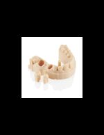 Żywica Denta Vision Everall7