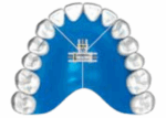Śruba 2-kierunkowa Bertoni B 4mm Dentaurum 1szt.